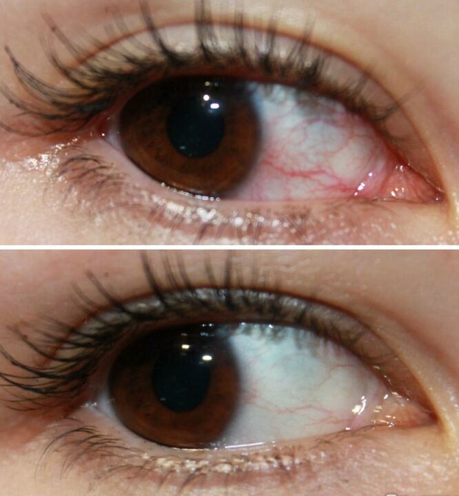 Ocuvit funcționează foarte repede